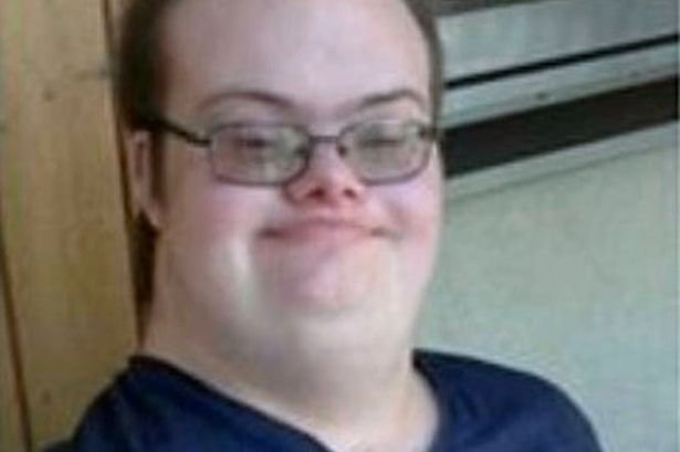 Vaizdo rezultatas pagal užklausą „down syndrome“